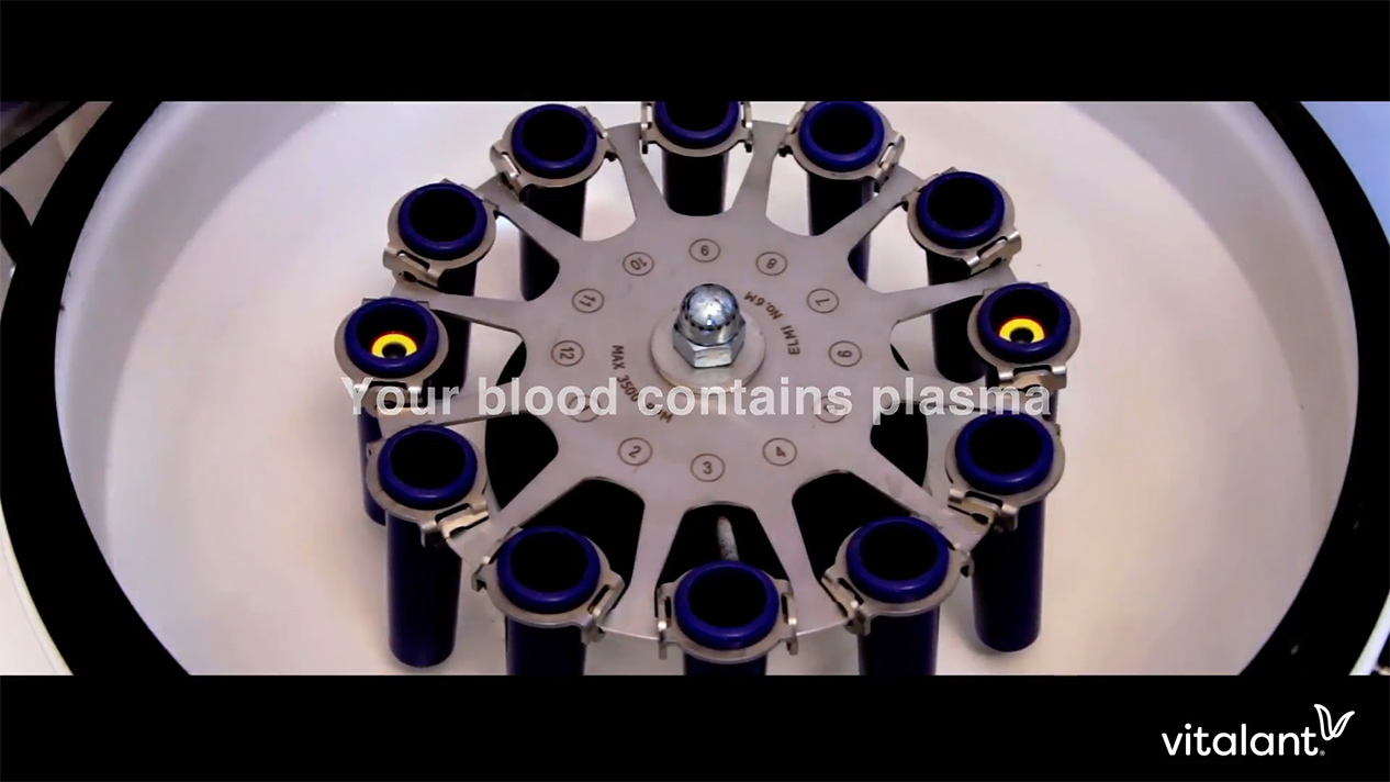 Plasma Donation Industry Today Leader in Manufacturing & Industry News